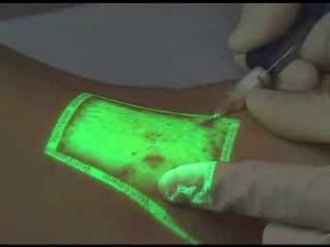 vein visualization device-03