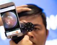 Samsung Vina khởi động “Dự án cải thiện chăm sóc sức khỏe nhãn khoa cho cộng đồng EYELIKE” tại Khu vực phía Nam